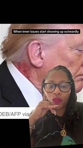 #greenscreen when inner issues start showing up outwardly #trump #ear #rash #issues