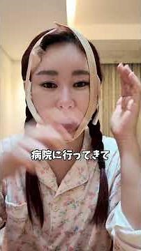 [Korean Plastic Surgery] Day 2 of my facelift recovery