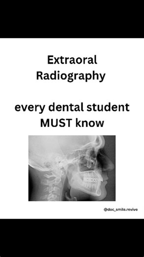 Dr priyanka on Instagram: "🦷 EXTRAORAL RADIOGRAPHS — MUST KNOW POINTS (EXAM READY) 1️⃣ Waters View (Occipitomental View) Angle: 🔹 37° Position: Orbitomeatal line 37° to film Shows: • Maxillary sinus • Zygomatic bone • Orbital floor Used in: Sinusitis, fractures ⭐ Most commonly asked angle 2️⃣ PA Skull View Angle: 🔹 0° (perpendicular) Position: Beam enters from occiput Shows: • Skull bones • Fractures • Paranasal sinuses 3️⃣ Lateral Cephalogram Angle: 🔹 90° (perpendicular) Position: Head fixe