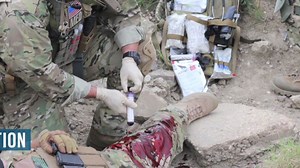 Invention seals gunshot wound in seconds