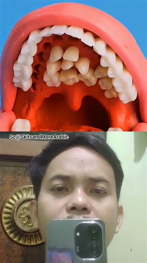 This woman has strange teeth !! SkitsandMoreArabic