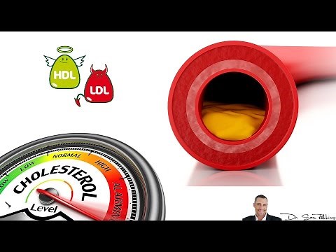 Cholesterol Levels Chart Explanation - HDL and LDL cholesterol - by Dr Sam Robbins