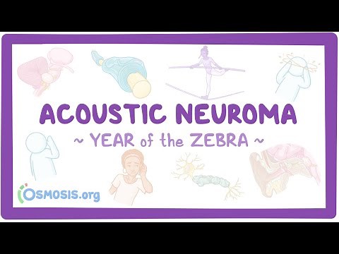 Acoustic neuroma (Year of the Zebra 2024)