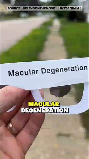 Visual Simulation of Vision Impairments