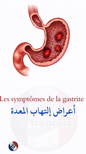 32K views · 826 reactions | #Les_symptômes_de_la_gastrite #أعراض_التهاب_المعدة. | Apprendre le français | Facebook