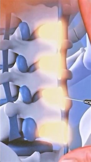 #fyr #spinalhealth #spinalanesthesia #lowerbackpain #lowerbody #peace #tolive