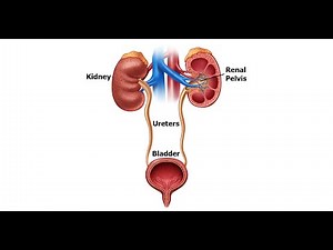 Pyelectasis (Dilated Fetal Kidney)