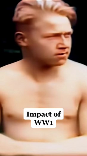 WW1 veteran with shell shock in 1918 (colorized) #ww1 #history #veteran