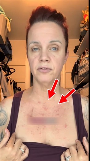 Sunlight Can Hurt Them… Here’s Why! #health #educationalvideo #education