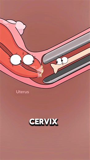 How Pap Smears Check for Cervical Cancer 🩺👀..!!#e2dhealth #animation #fypシ #2dshow #health