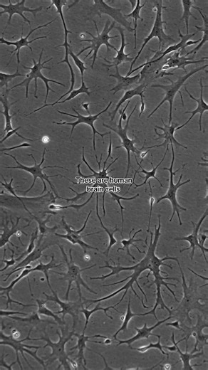 Growing Human Brain Cells in the Lab: Discoveries Unlocked