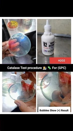 Catalase Test procedure 🧑‍🔬🦠 For GPc #viralreels #labtechnicians #medicalstudent #bmltstudents #dmlt