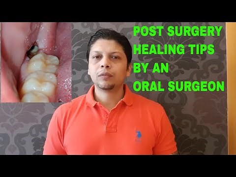 Post Surgery instructions by an oral surgeon [after Tooth Extractions,bone grafting,implants]