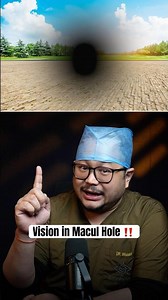 Vision when you have Macular Hole 😱 #shorts #eyehealth #eyecare #healtheducation