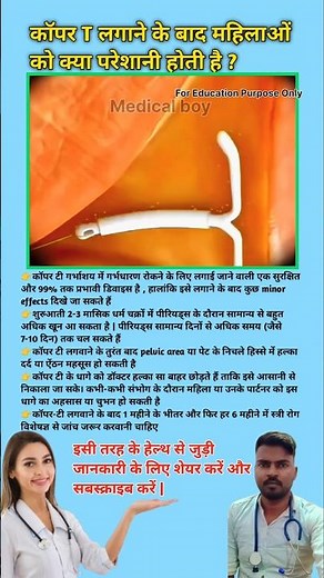 What problems do women face after getting a Copper T inserted? Function of Copper T || #viral #co...
