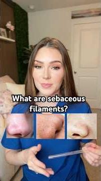 Sebaceous filaments 🥤🧴 #sebaceousfilaments #skincare #skinadvice #dermatology #pores