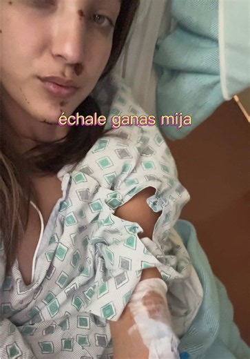 5 weeks strong today 💪🏼💜🎗️ #jawsurgeryrecovery #mandibula #convulsiones #epilepsyawareness #epilepsia