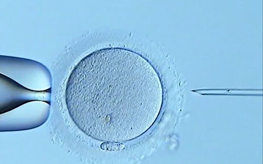 显微镜实拍卵细胞浆内单细胞注射（ICSI）技术的实现