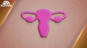 Ovarian cancer study