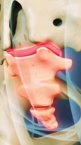 57K views · 426 reactions | Coccydynia, or tailbone pain, is persistent pain at the bottom of the spine due to injury or inflammation in or around the coccyx. | Spine-health | Facebook