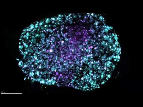 Exploring Prostate Organoids in 3D with LUMI