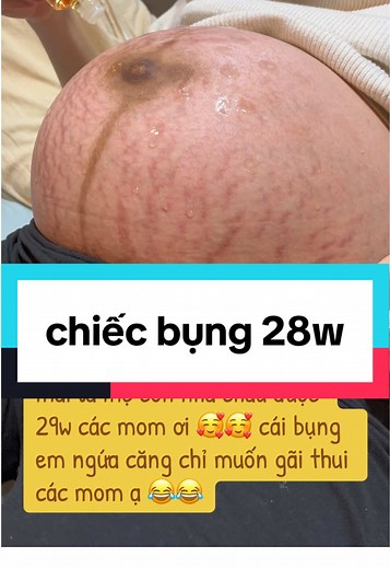 Kem Rạn Da Nhất Định Cho Bà Bầu 29 Tuần