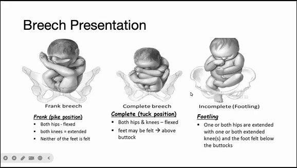 Abnormal Pregnancy | By Dr. Dawit Mesfin | Blue Health Ethiopia | Virtual Seminar