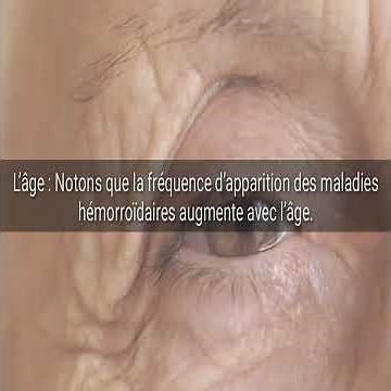 Les causes des hémorroïdes les plus fréquentes