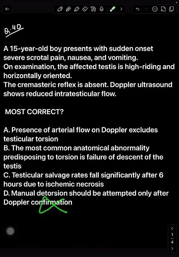 Testicular Torsion MCQ l Time Is Testis
