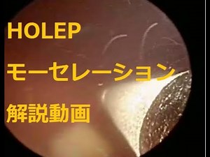 HOLEPゆっくり手術解説動画 モーセレーション編