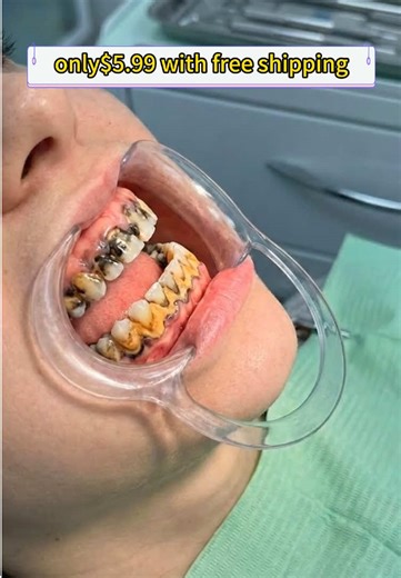 Unbelievable Deal on Purple Whitening Toothpaste