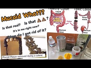 Mucoid Plaque & How to Get Rid of It