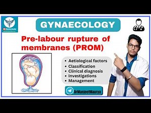 PROM Explained | Pre-Labour Rupture of Membranes | Causes, Diagnosis & Management | Obstetrics