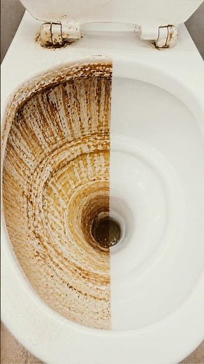 Stop Ignoring These Toilet Stains!
