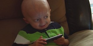 Kentucky boy with Progeria stays strong; Family fights for research
