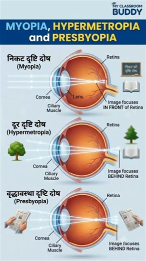 Learn Eye Defects Fast! Myopia, Hypermetropia & Presbyopia 👁️📚 #myclassroombuddy #science