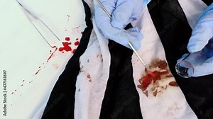 fresh splatter of blood on white table, stains on tissue at crime scene, blood sample collection tube, forensic scientist examining samples, forensic medical examiner work concept, police laboratory