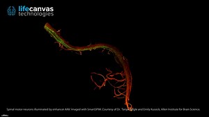 Spinal motor neurons illuminated by enhancer AAV