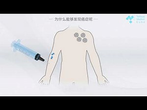 什么是PET/CT检查