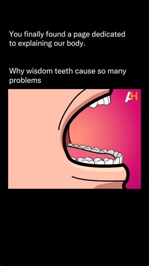Explaining Our Body on Instagram: "Wisdom teeth cause so many issues comes down to evolution and space. Wisdom teeth, also known as third molars, are the last teeth to erupt, usually between the ages of 17 and 25. Thousands of years ago, human jaws were larger and diets were tougher, so these extra molars helped with grinding food. Modern humans, however, have smaller jaws — and often not enough room to accommodate them. Because of this lack of space, wisdom teeth frequently grow in at awkward a
