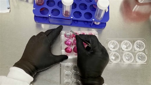 Direct and Indirect Culture Methods for Studying Biodegradable Implant Materials In Vitro