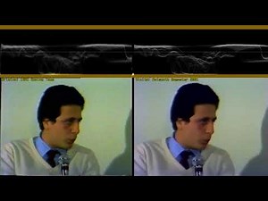 1981 Italian VHS Remastered through Avisynth 2021