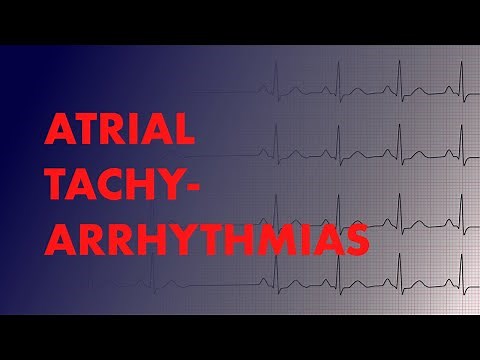 Atrial Arrhythmias (A-fib vs A-Flutter vs Focal vs Multifocal Atrial Tachycardia) - MEDZCOOL