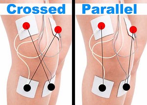 BEST Tens Placement for Knee Pain