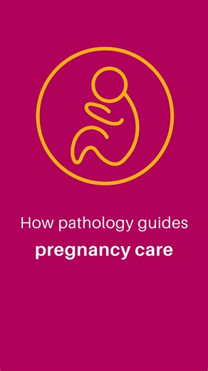 Douglass Hanly Moir Pathology on Instagram: "Pathology testing plays an essential role in pregnancy care by providing information that supports clinical decision-making. Routine tests may help healthcare providers monitor your health and identify changes over time. A Cervical screening test may be one of the tests your doctor recommends as part of routine care, and can help them assess cervical health and determine appropriate follow-up where needed*. Learn more about the cervical screening test