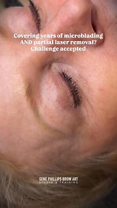 When a brow has gone through multiple microblading sessions plus a year or two of laser removal, the skin will always tell a story. Different tones, uneven saturation, and areas that no longer hold color well — that’s when precision and realistic design become crucial. We didn’t aim for something overly bold or big. Instead, we focused on a shape that respects the skin’s limitations, blends into the existing tones, and still gives a beautiful, elevated structure. My client fully understood the r