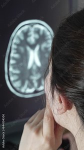 Neuroradiologist Analyzing Brain MRI. A woman viewed from behind examines a brain MRI scans on the screen, scrolling through the axial T2 sequence. Concept of brain diagnosis