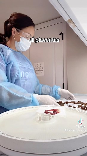 Congrats again to Mama M! Placenta processing video for her and her sweet girl born 6.2.23! 👣💖 #certifiedplacentaencapsulator #placentaencapsulation #placentapills #placentacapsules #placenta #postpartumhealing #postpartumrecovery #postpartum #naturalbirthhealing #naturalbirth #midwestplacentaencapsulation #healthypregnancy #midwestplacenta #encapsulateitdonttrashit #placentophagy | Midwest Placenta Encapsulation