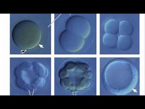 How The Sea Urchin Got Its Guts