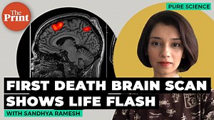 Doctors studying a patient’s brain during a seizure ended up accidentally capturing brain scans as the man suffered a fatal heart attack and died during the scan. The man’s brain data reveals that people might indeed have their whole life flash in front of their eyes when they die. ThePrint’s Sandhya Ramesh explains the findings. Subscribe to the Pure Science Telegram Channel https://t.me/PureScienceWithSandhyaRamesh Supplementary reading: Vicente et al., Frontiers in Aging Neuroscience (2022) E